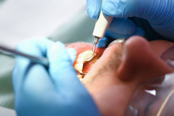Best After-Hours Dental Trauma Care in New Fairview, TX