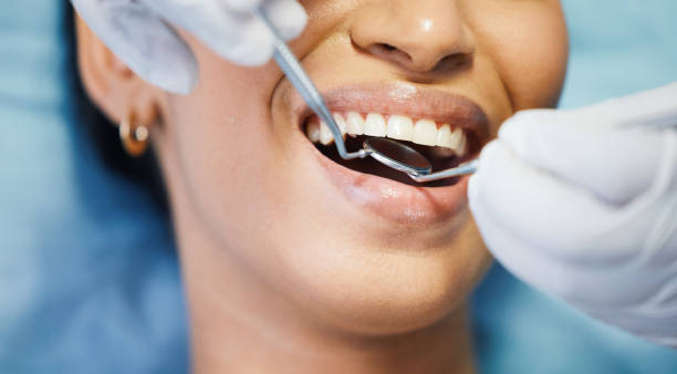 Best Emergency Dental Care for Broken or Chipped Teeth in New Fairview, TX